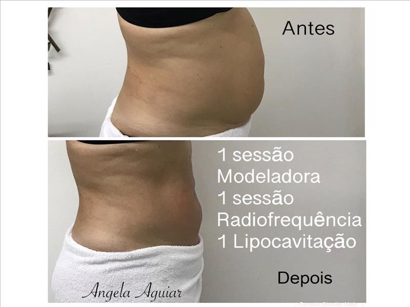 Dia da Noiva ou Debutante, Madrinhas, convidadas, estética facial e corporal!