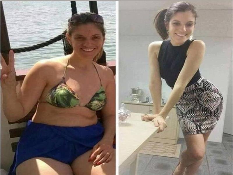 Emagrecimento com saúde e estética
